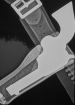xray (1).jpg