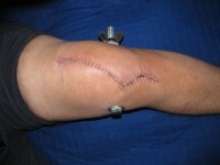 Knee 009.JPG