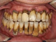 Teeth.jpg