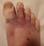 foot.jpg