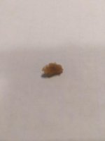Kidney Stone 8.22 mm.jpg