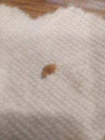 Kidney Stone 012.jpg