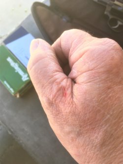 tph bite.JPG